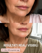 Novalya™ | Stick Lifting Collagene Rosa & PDRN