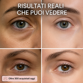 Novalya™ | Stick Lifting Collagene Rosa & PDRN