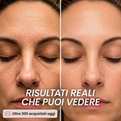 Novalya™ | Stick Lifting Collagene Rosa & PDRN