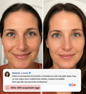 Novalya™ | Stick Lifting Collagene Rosa & PDRN